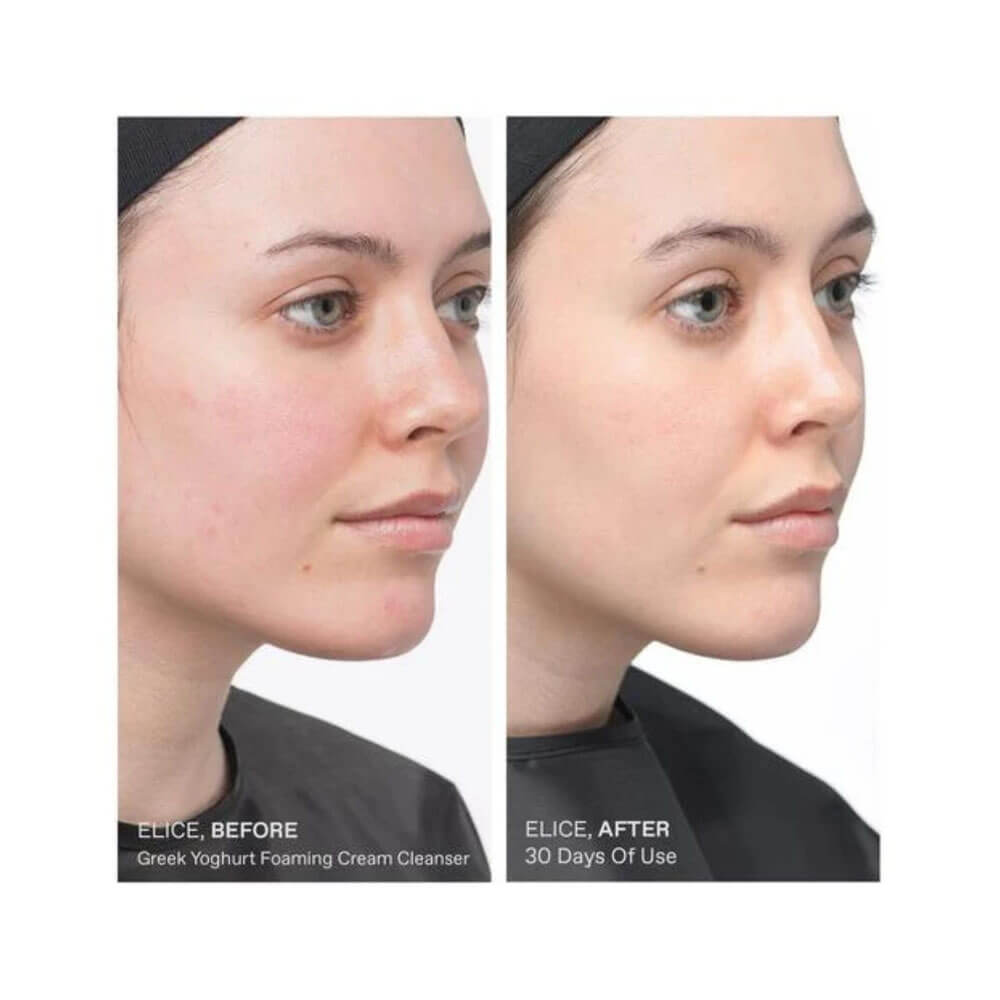 Comparativo antes e depois do uso do limpador facial Korres Greek Yoghurt