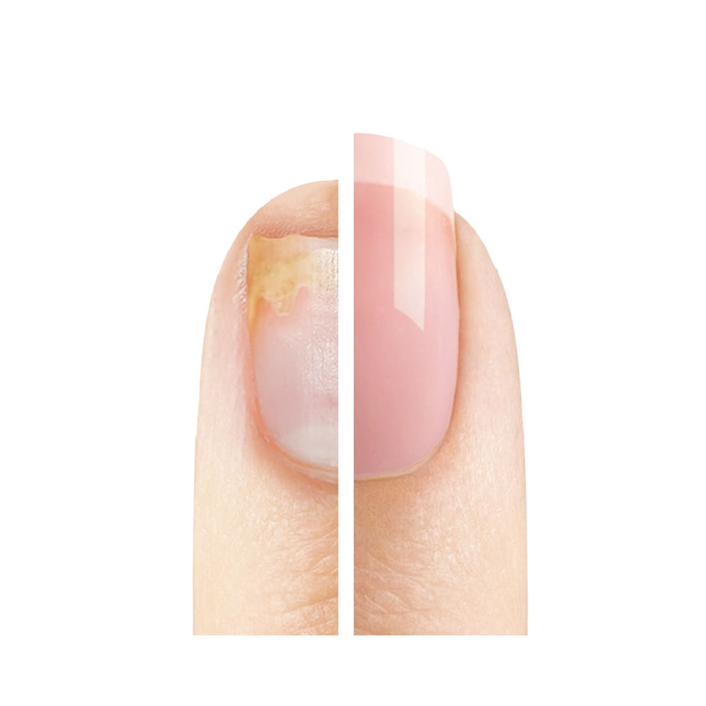 Comparativo unha antes e depois do uso da Base Fortalecedora Blant